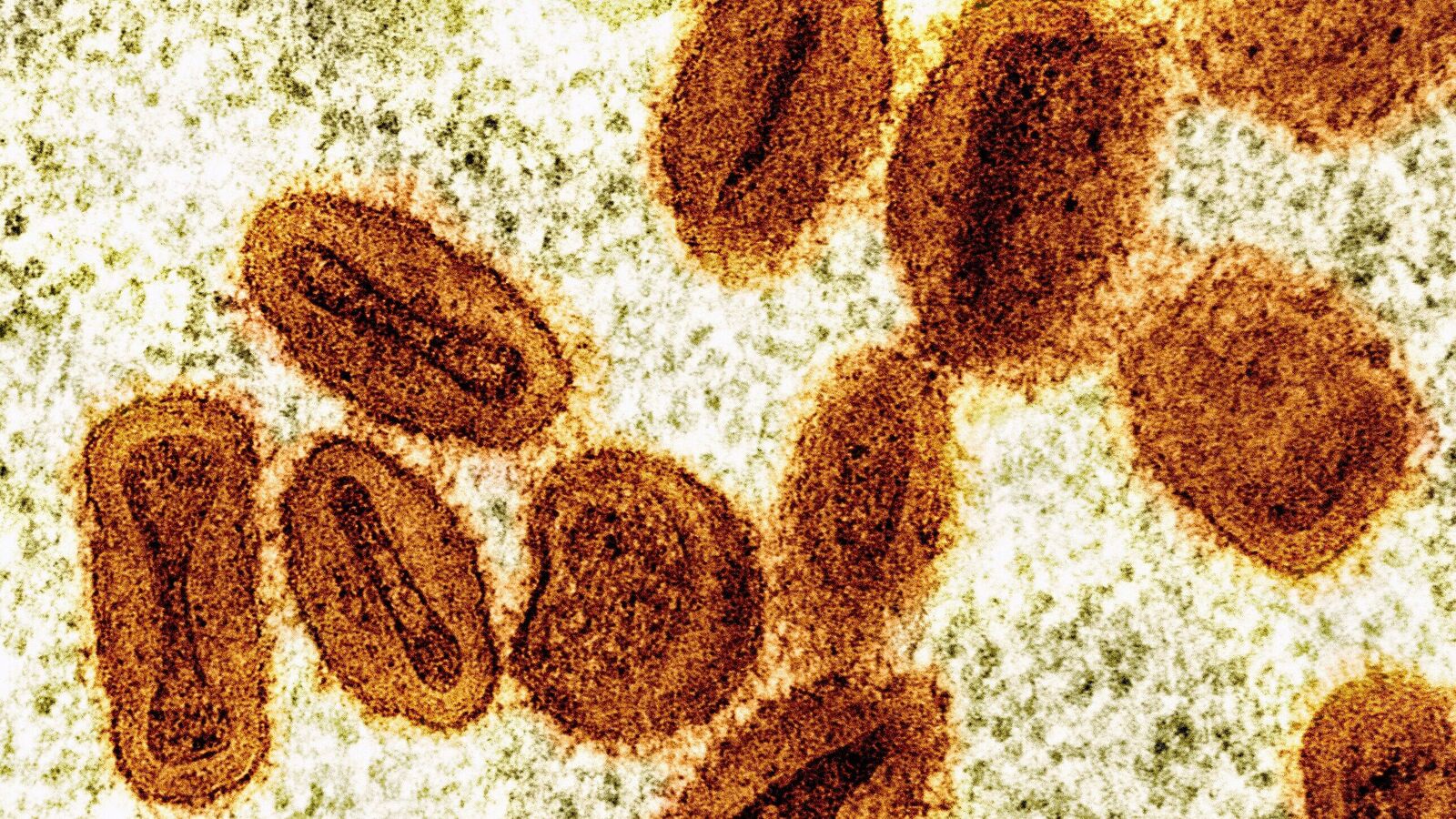 This colorised electron microscope image provided by the National Institute of Allergy and Infectious Diseases in 2024 shows Mpox virus particles