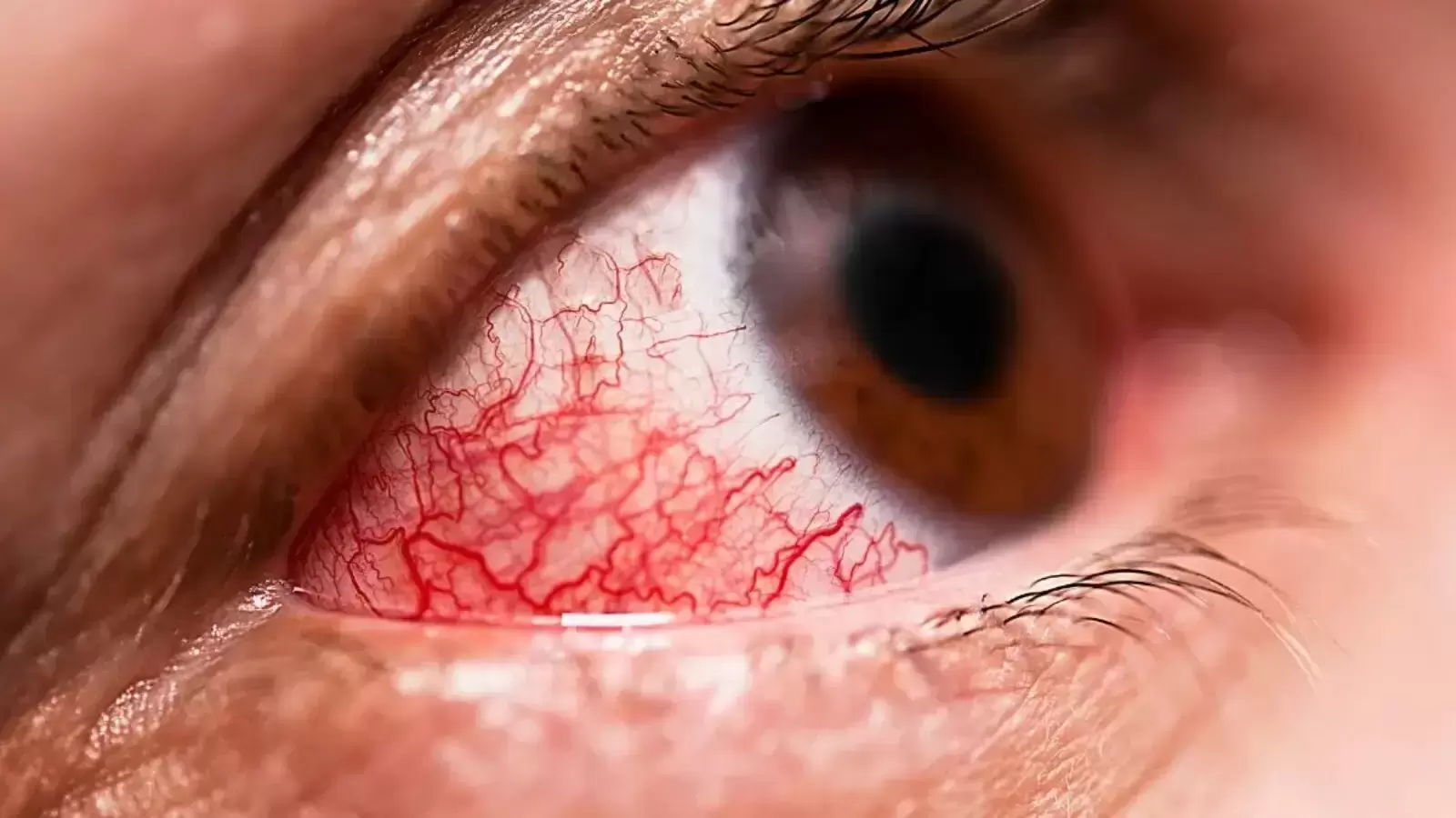 How does air pollution affect your eyes?